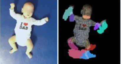 Analysis of motor development within the first year of life: 3-{D} motion tracking without markers for early detection of developmental disorders