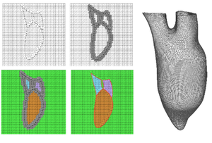 Reconstructing patient-specific cardiac models from contours via Delaunay triangulation and graph-cuts