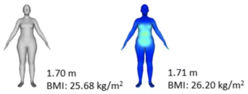 Body Image Disturbances and Weight Bias After Obesity Surgery: Semantic and Visual Evaluation in a Controlled Study, Findings from the BodyTalk Project 